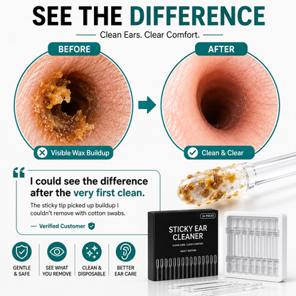 Dual-Ended Sticky Ear Cleaner – Lift Wax Out, Don’t Push It Deeper